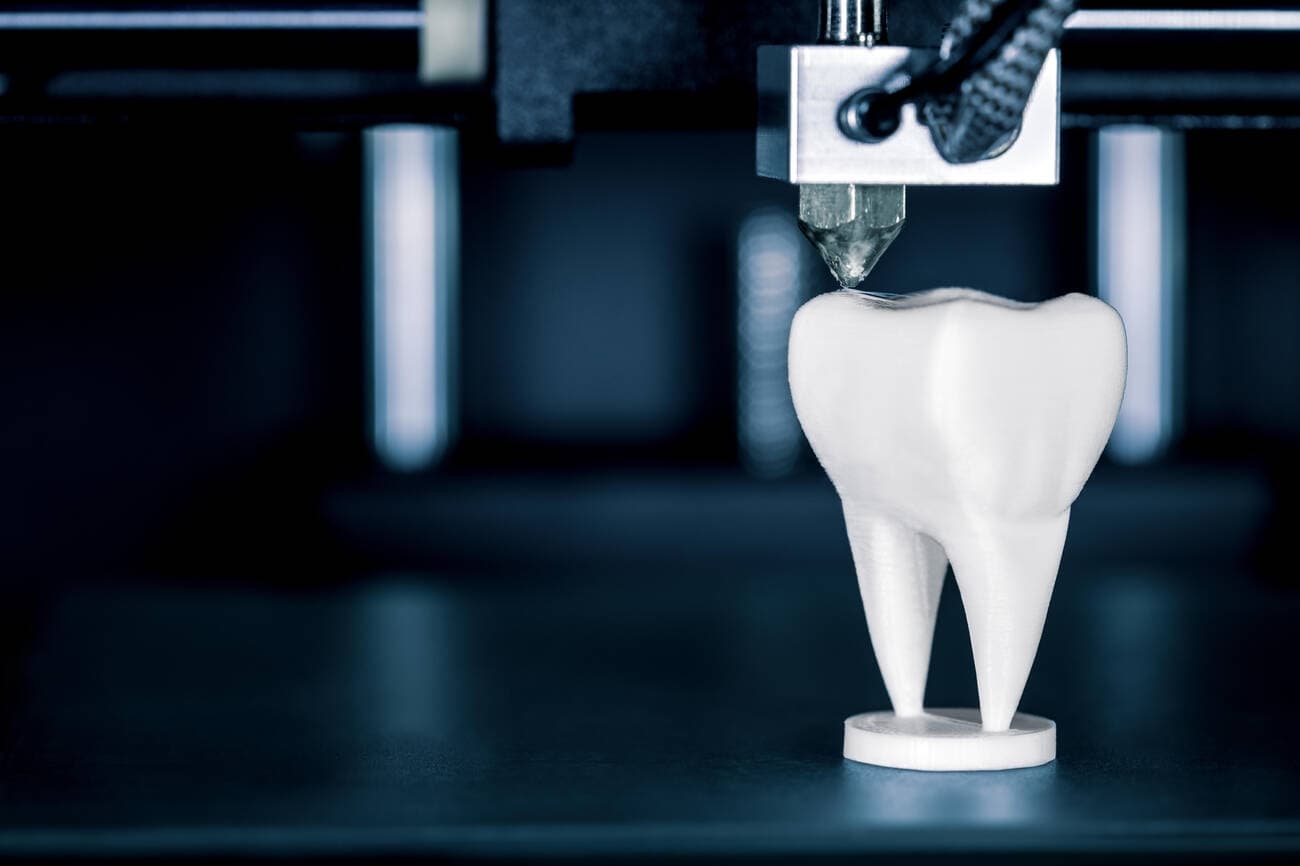 Illustrative example of 3d printed dental implants from Google Search