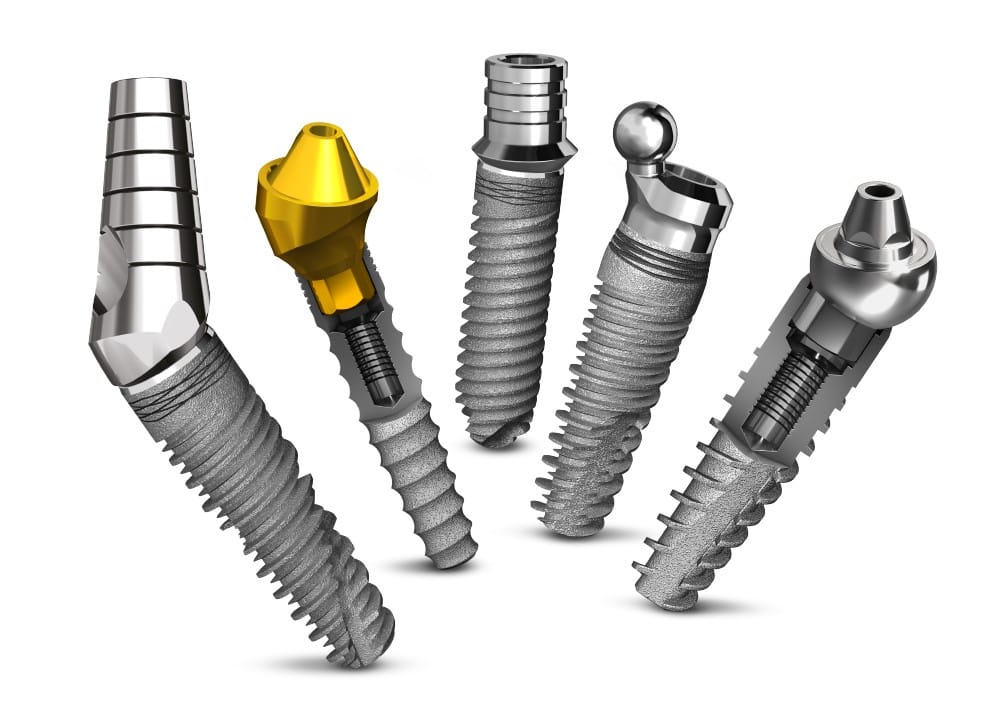 Illustrative example of ab dental implants from Google Search