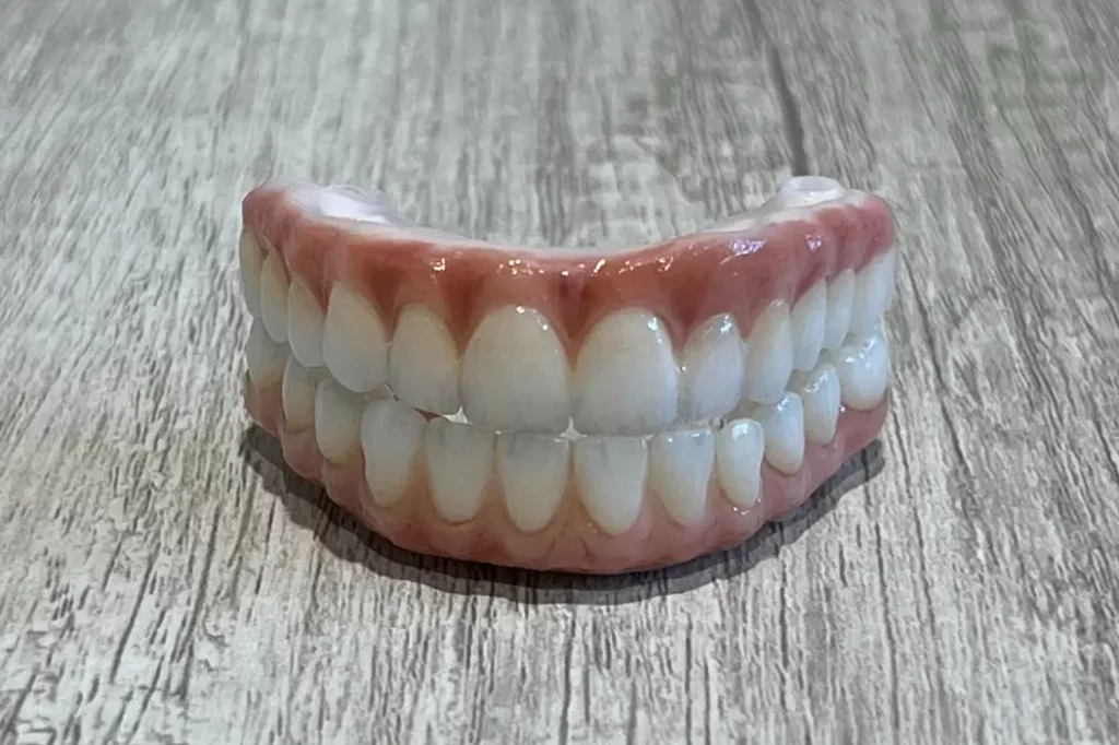 Illustrative example of all on 4 dental implants financing from Google Search