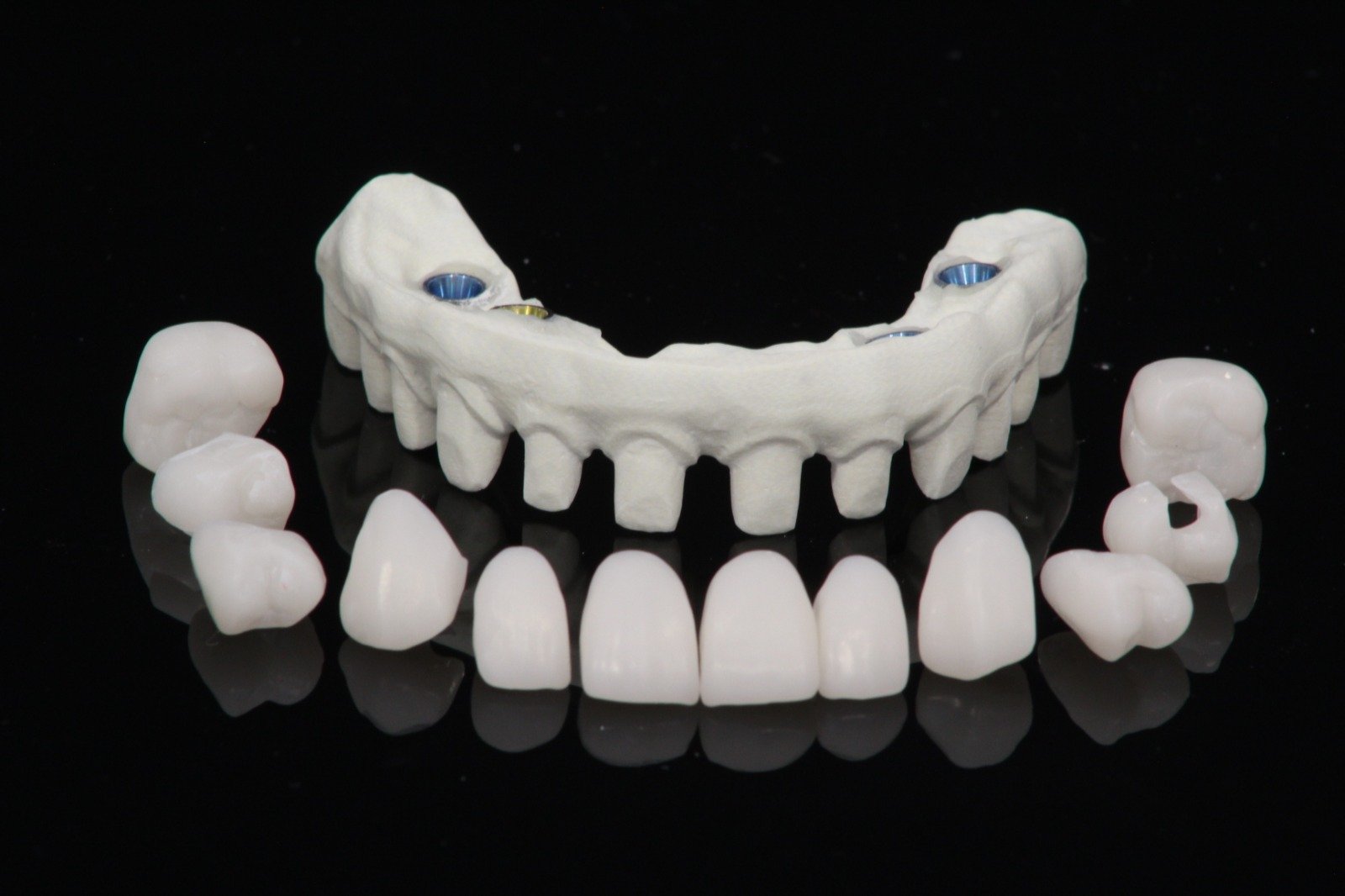 Illustrative example of all on 4 dental implants mexico from Google Search