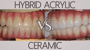 Illustrative example of all on 4 dental implants reviews from Google Search