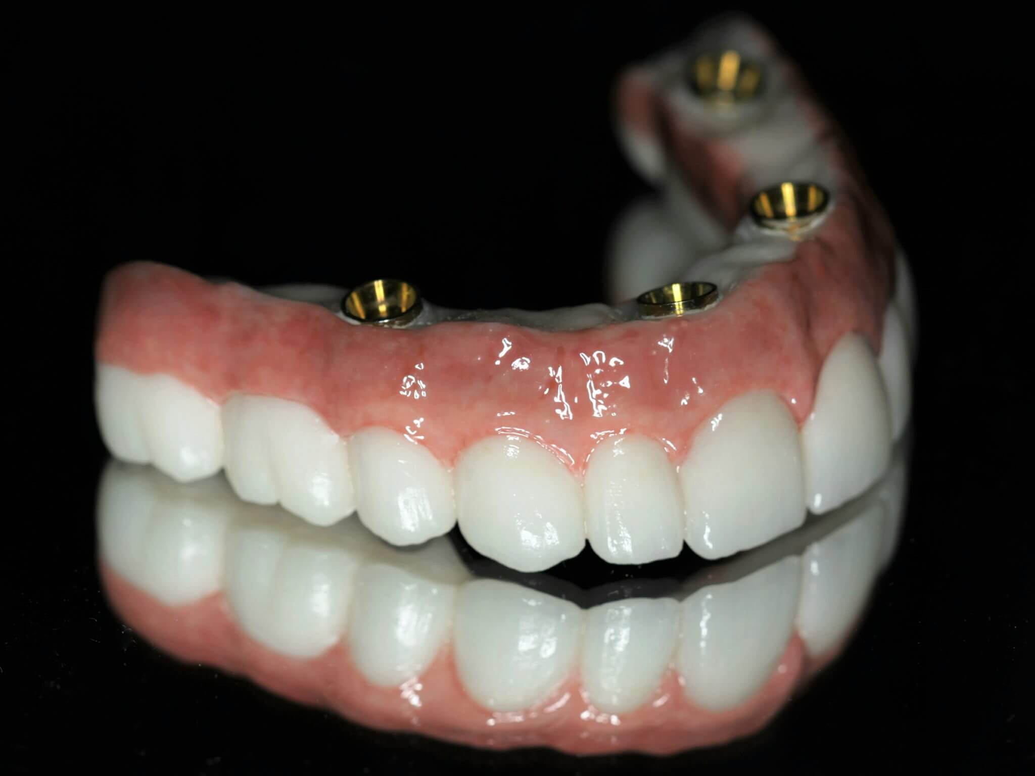 Illustrative example of all on 4 dental implants zirconia from Google Search
