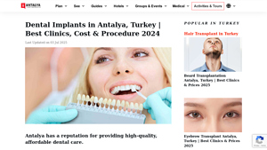 Dental Implants in Antalya, Turkey | Best Clinics, Cost & Procedure 2024 - best dental implants in turkey