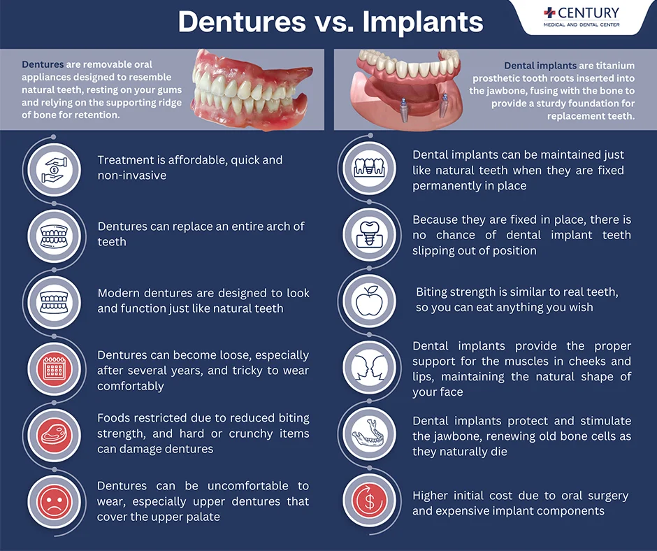 Illustrative example of are dental implants better than dentures from Google Search
