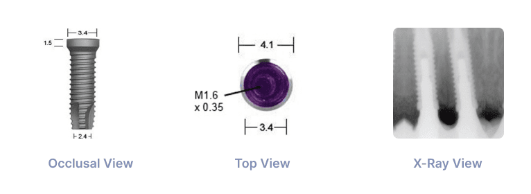 Illustrative example of biomet 3i dental implants from Google Search