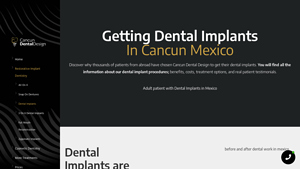 GET DENTAL IMPLANTS IN CANCUN MEXICO | Titanium・Zirconia - best dental implants in mexico