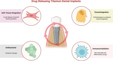 Illustrative example of caring for dental implants from Google Search