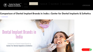 Comparison of Dental Implant Brands in India - top dental implants