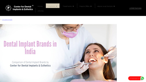 Comparison of Dental Implant Brands in India - best dental implants