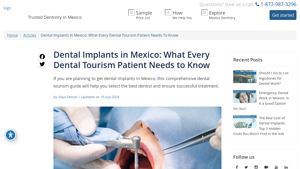 Dental Implants in Mexico: What You Need to Know - Cost, Process, Types - best dental implants in mexico