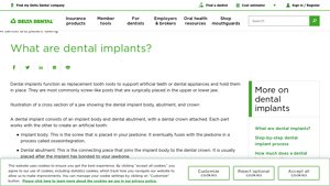 Dental Implants Guide: Overview, Types, Procedure & More - best dental implants