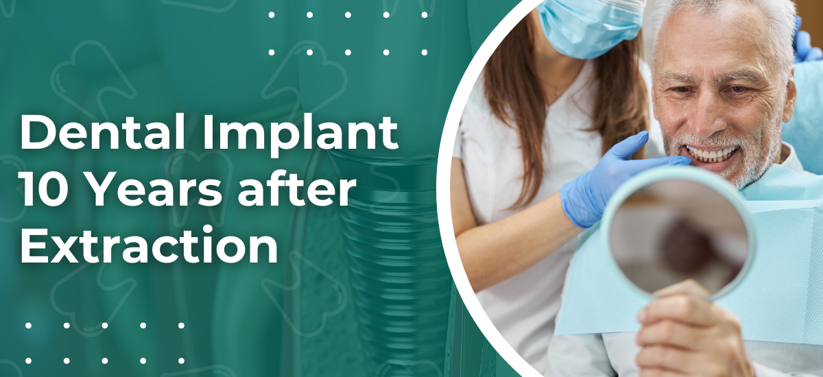 Illustrative example of dental implant 10 years after extraction from Google Search