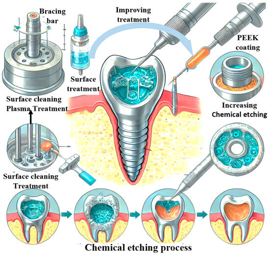 Illustrative example of dental implant adhesive from Google Search