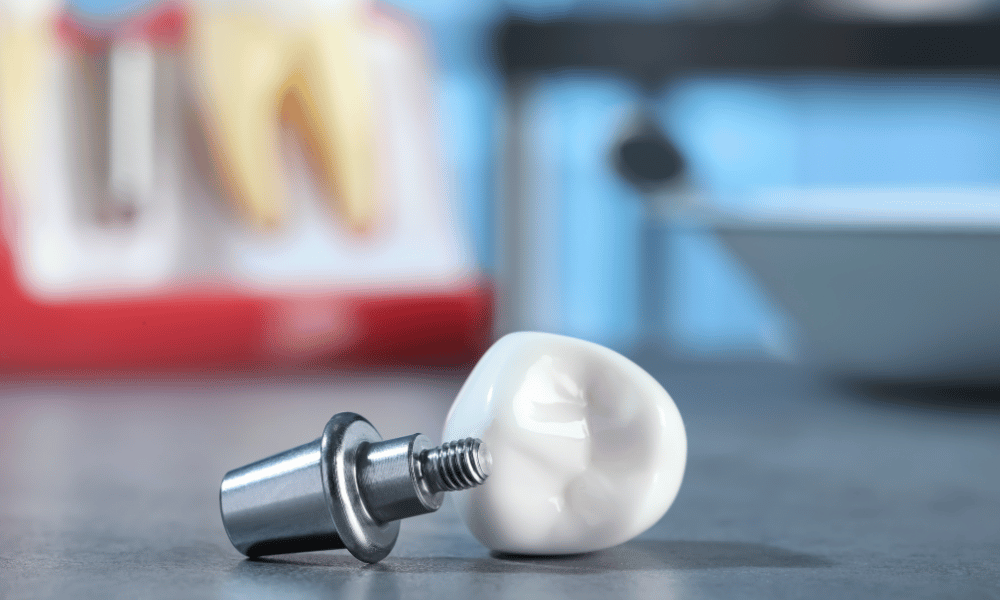 Illustrative example of dental implant custom abutment from Google Search