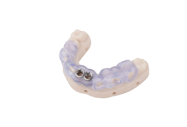 Illustrative example of dental implant lab from Google Search