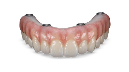 Illustrative example of dental implant lab from Google Search