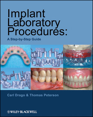 Illustrative example of dental implant laboratory from Google Search