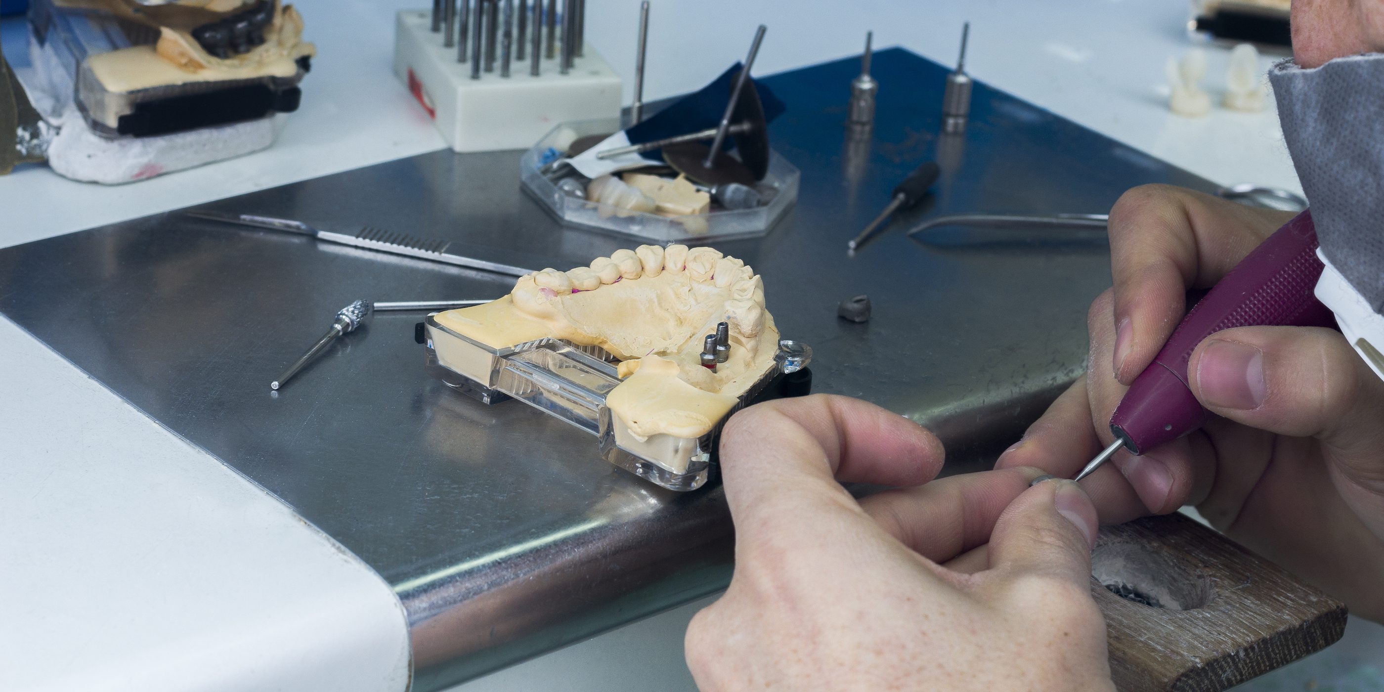 Illustrative example of dental implant laboratory from Google Search