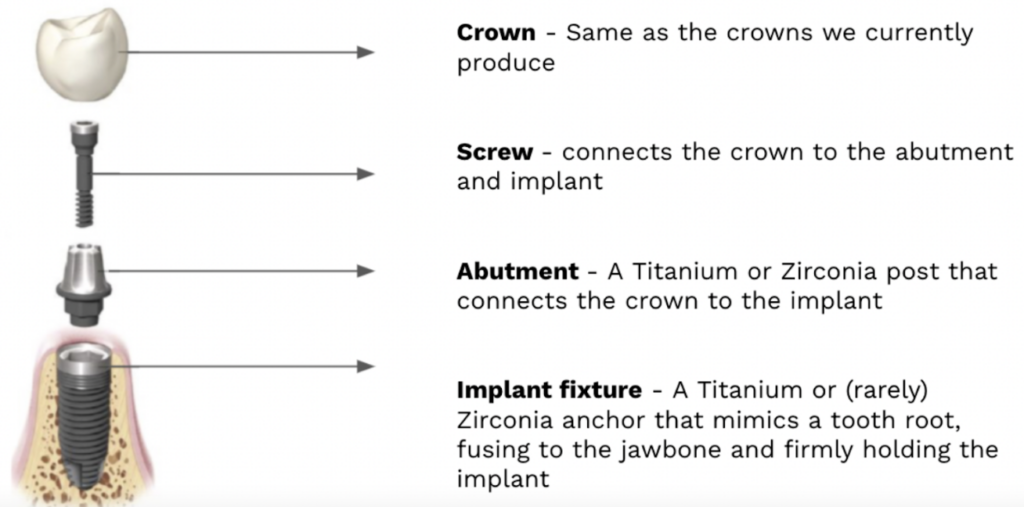 Illustrative example of dental implant parts from Google Search