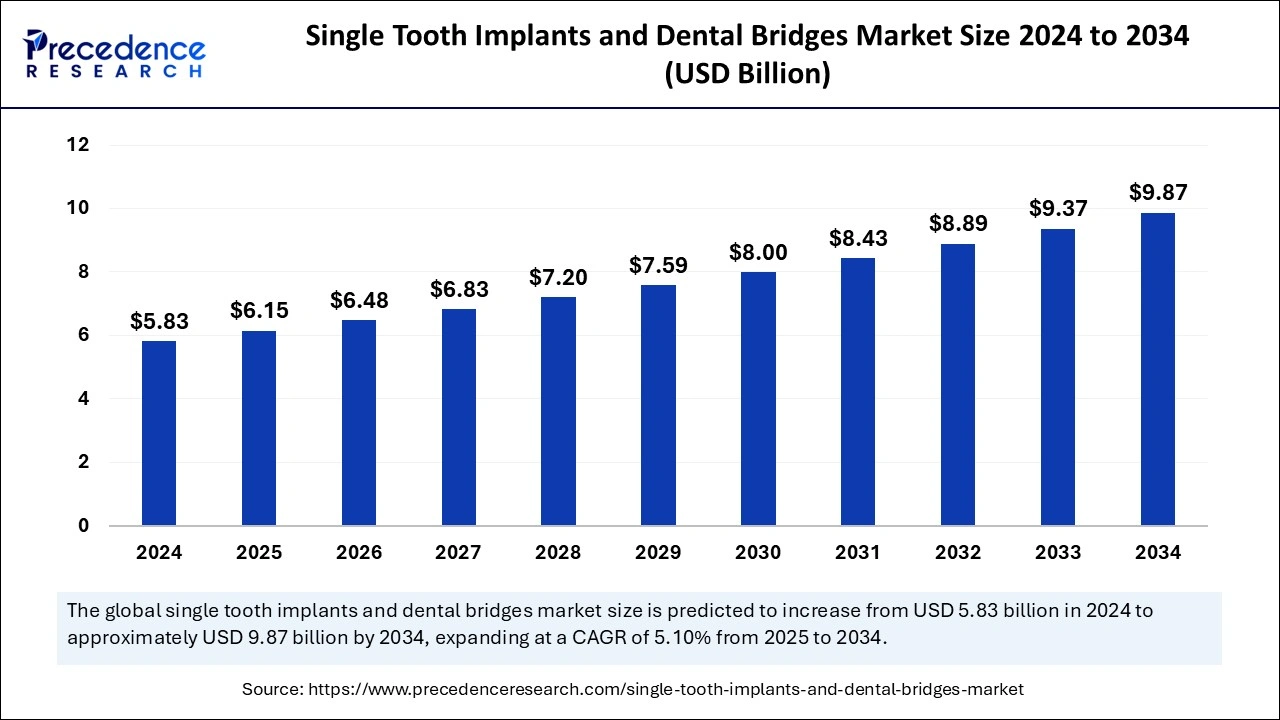 Illustrative example of dental implant rate from Google Search
