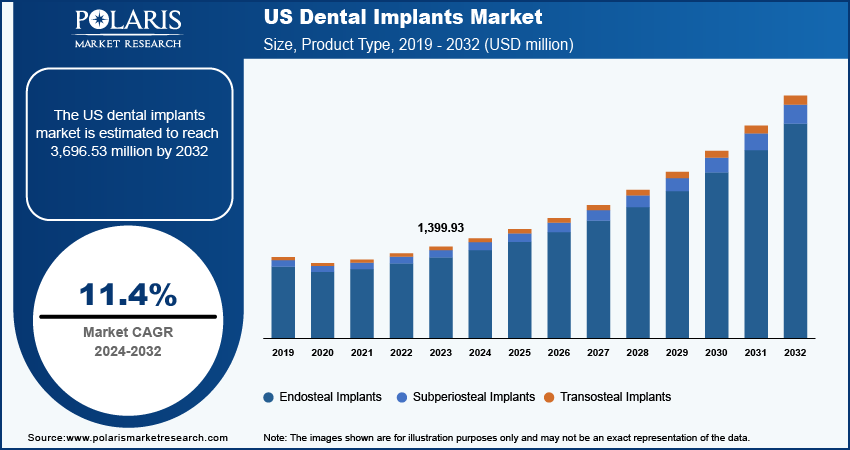 Illustrative example of dental implant rate from Google Search