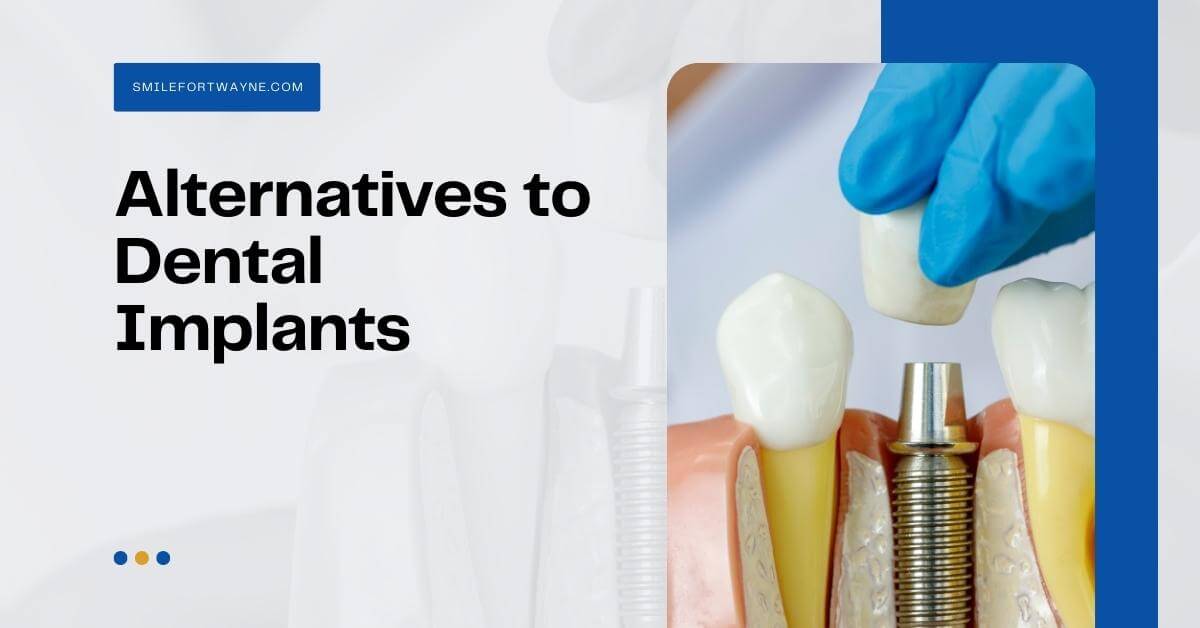 Illustrative example of dental implant substitute from Google Search