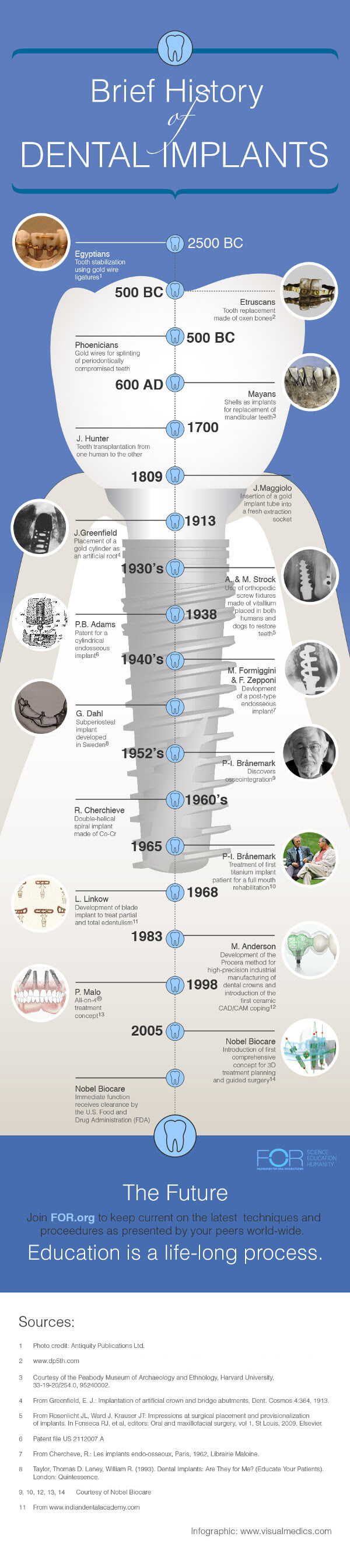 Illustrative example of dental implant timeline from Google Search