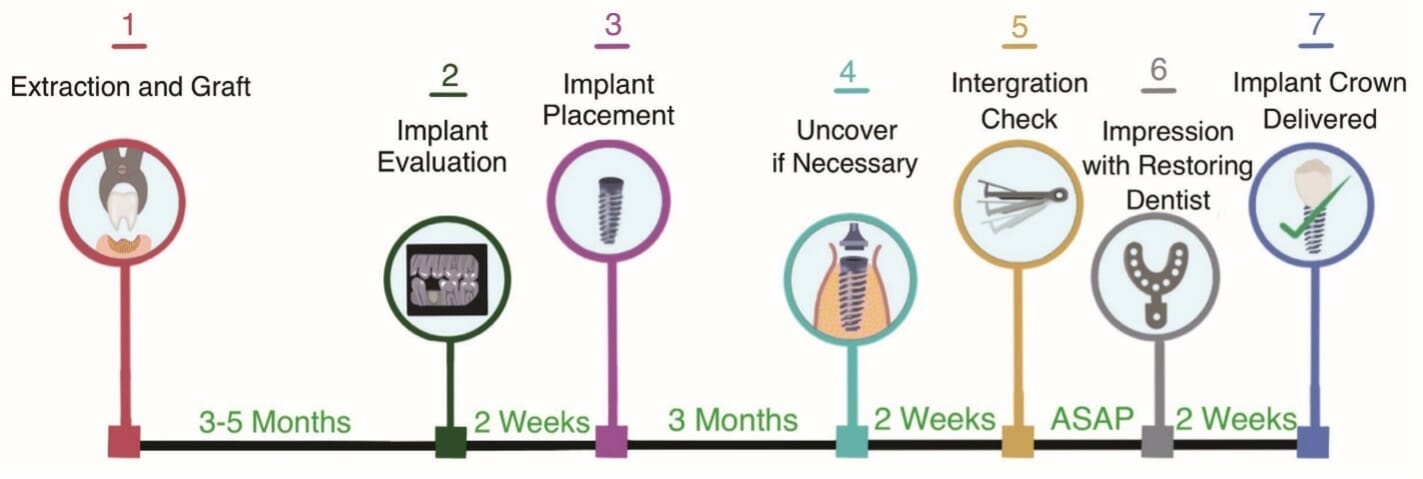 Illustrative example of dental implant timeline from Google Search