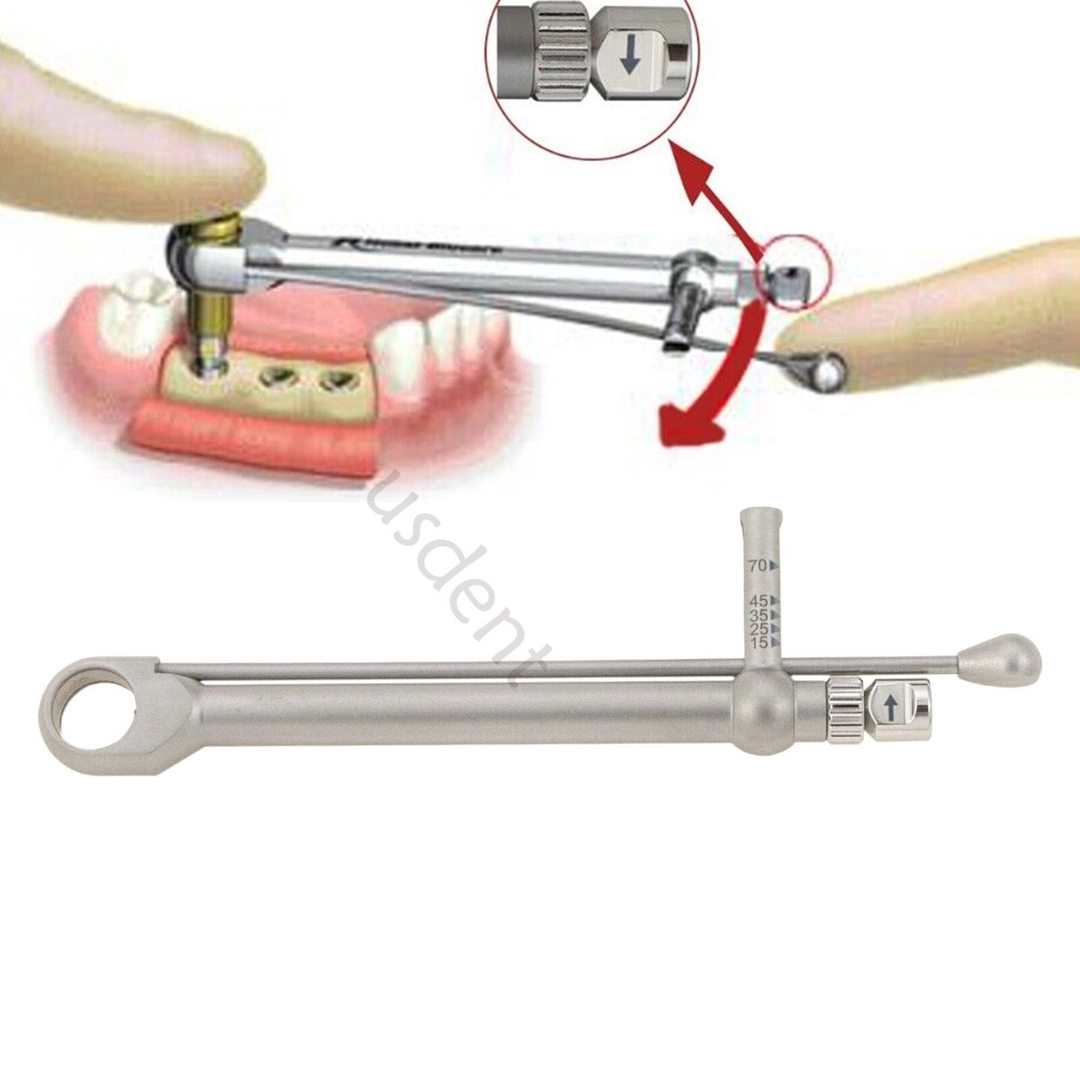 Illustrative example of dental implant torque wrench from Google Search