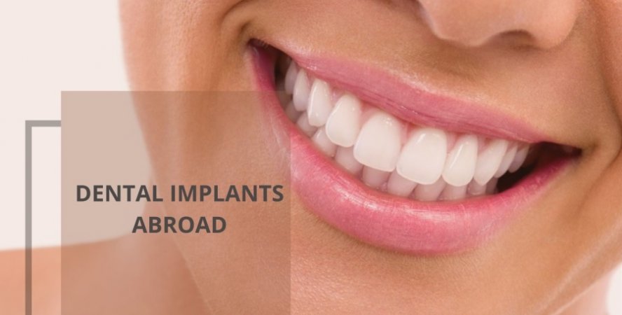 Illustrative example of dental implants abroad from Google Search