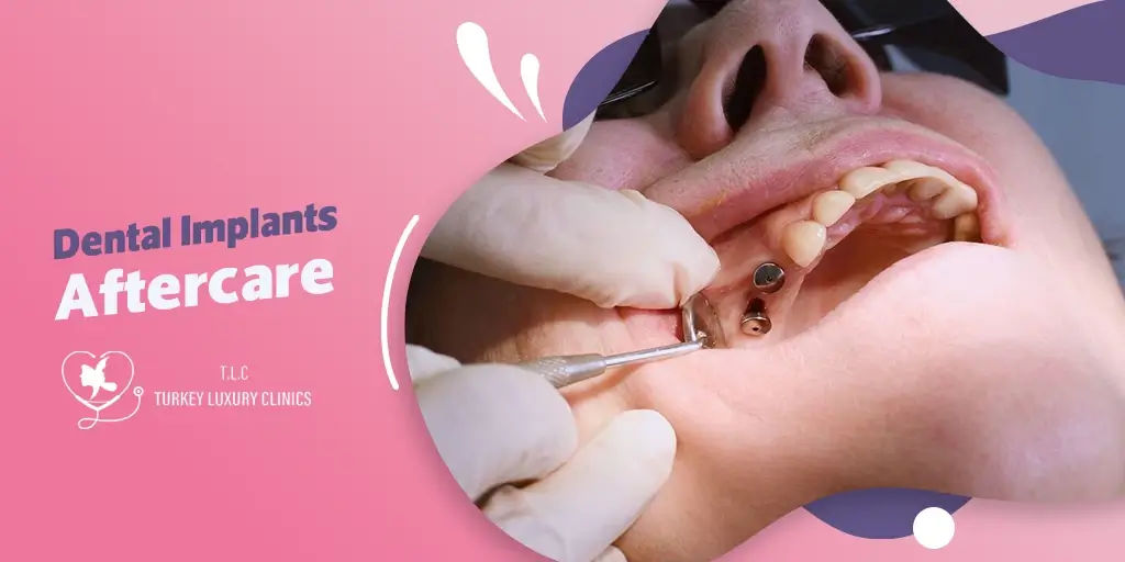 Illustrative example of dental implants aftercare from Google Search