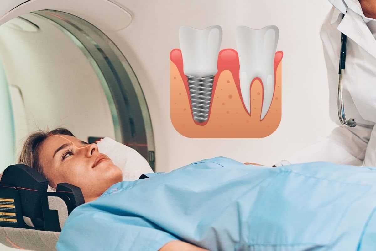 Illustrative example of dental implants and mri from Google Search