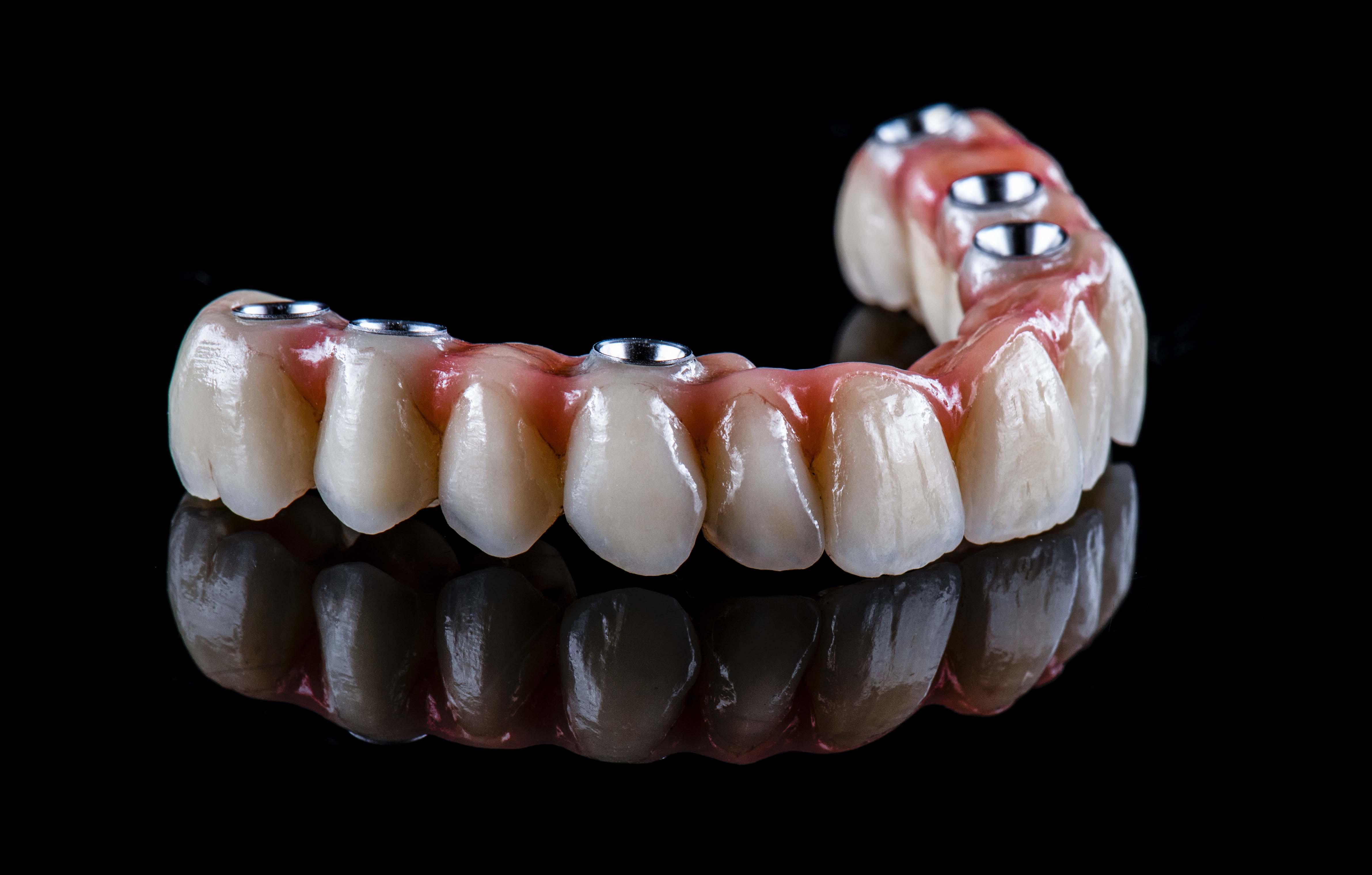 Illustrative example of dental implants for entire mouth from Google Search
