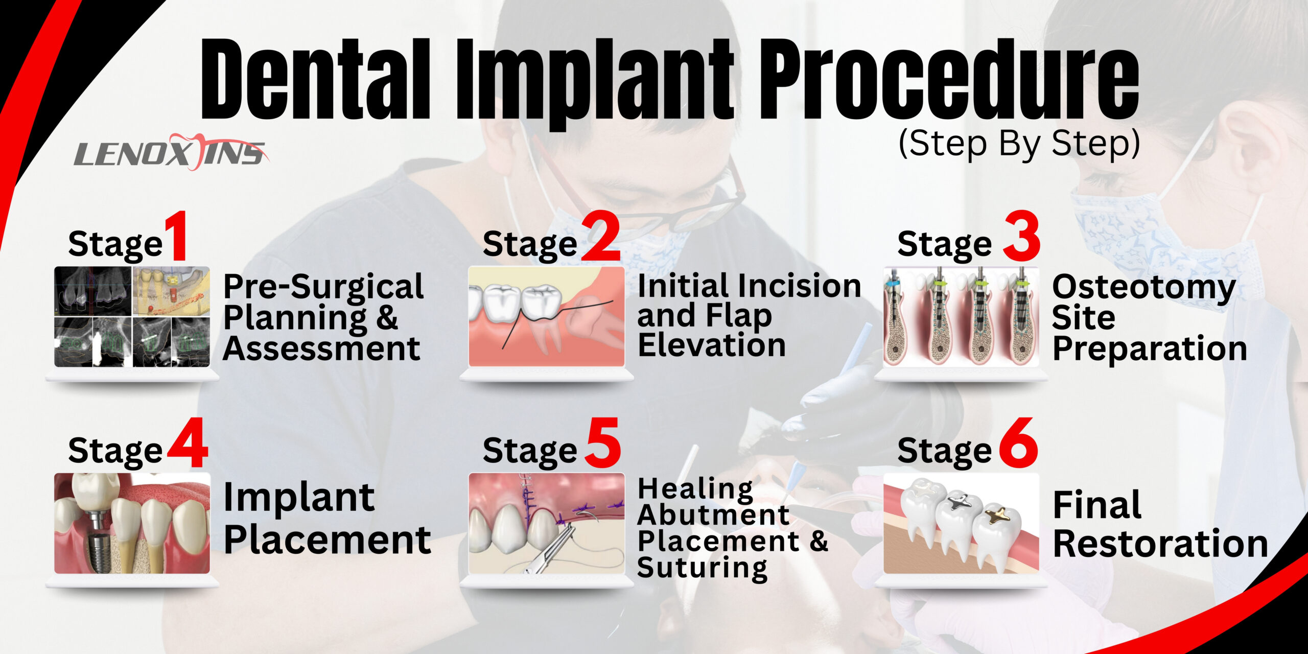 Illustrative example of dental implants procedure steps from Google Search