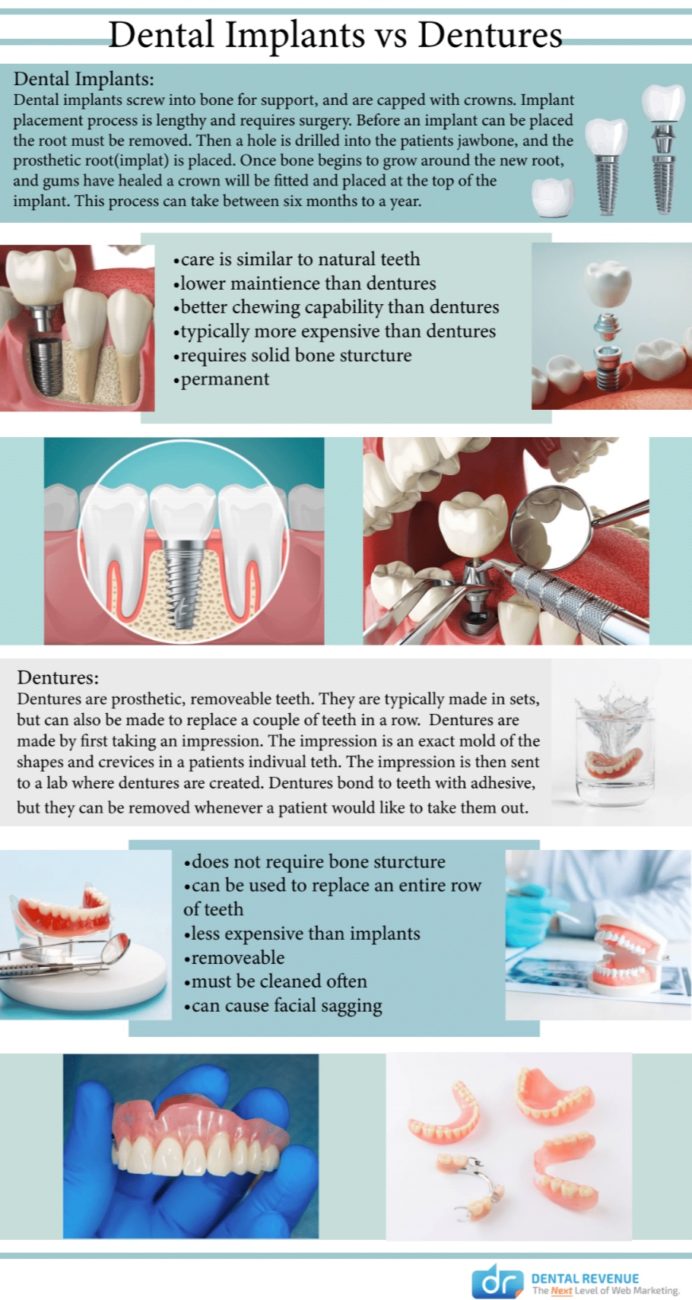 Illustrative example of dental implants versus dentures from Google Search