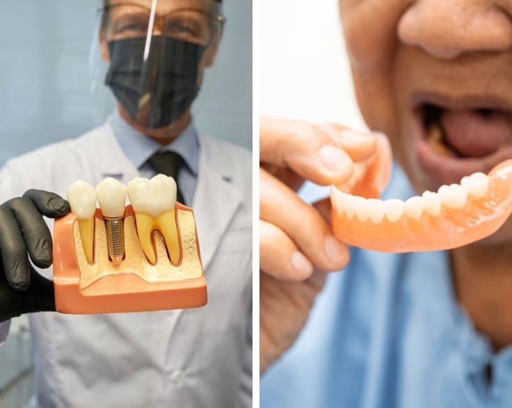 Illustrative example of dental implants vs dentures from Google Search