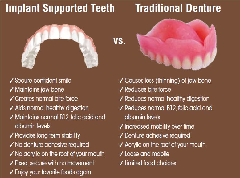 Illustrative example of dental implants vs dentures from Google Search