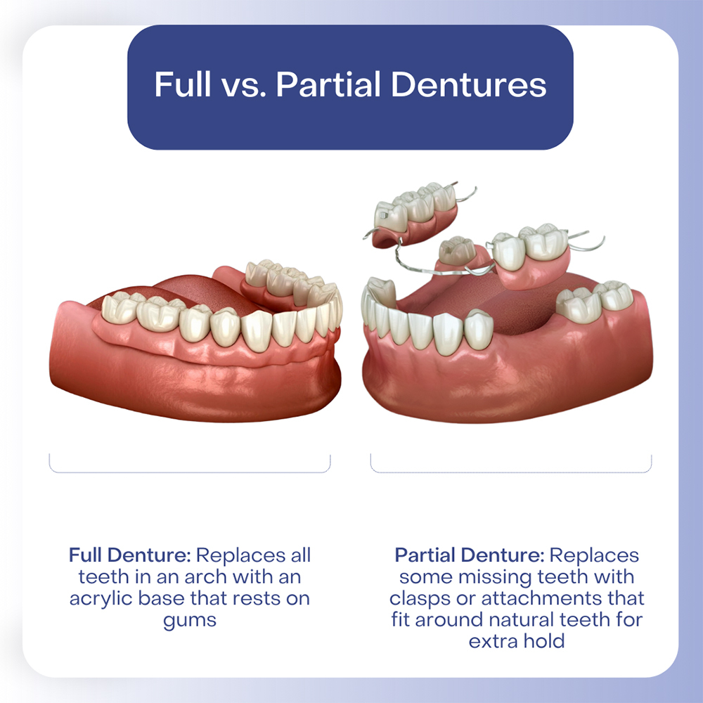 Illustrative example of dental implants with removable dentures from Google Search