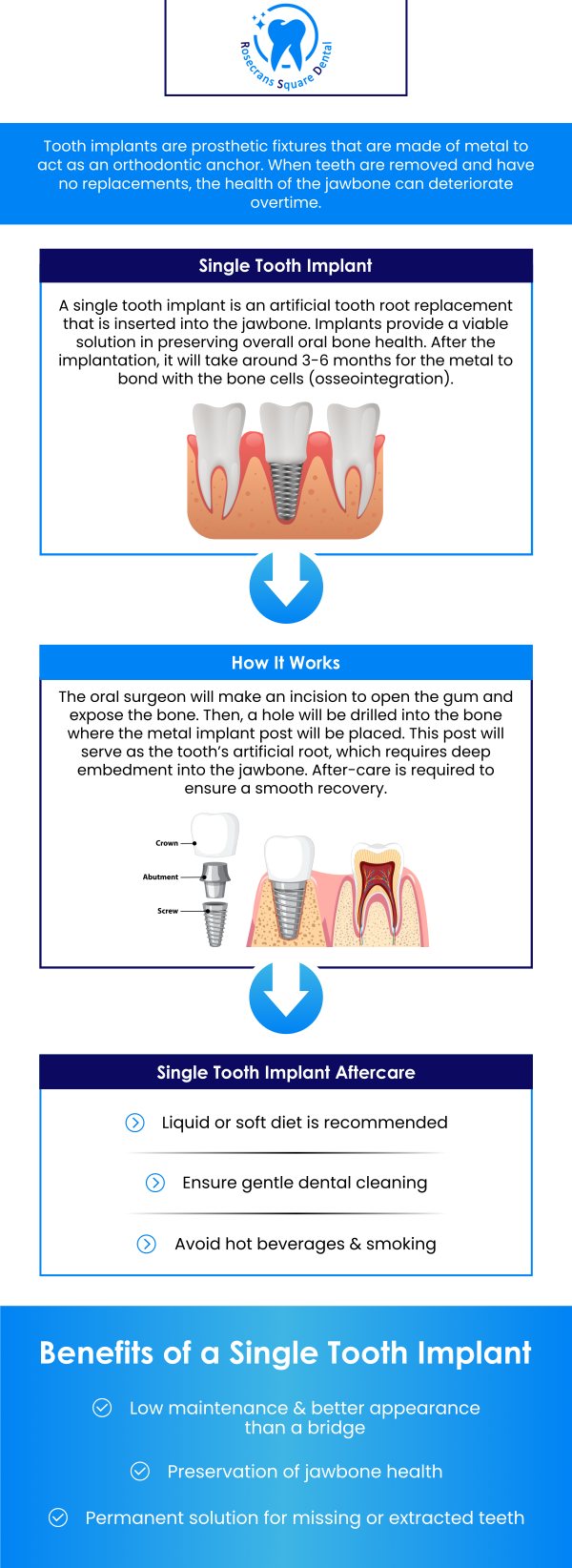Illustrative example of dental implants without insurance from Google Search