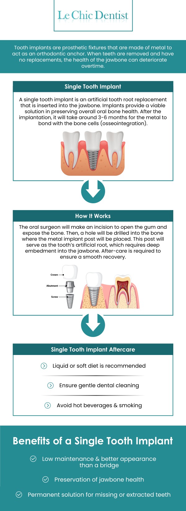 Illustrative example of dental implants without insurance from Google Search