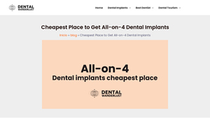 Cheapest Place to Get All-on-4 Dental Implants - cheapest all on 4 dental implants