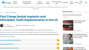 Cheap Dental Implants US: Low-Cost and Affordable Options - Dentaly.org - best deal on dental implants
