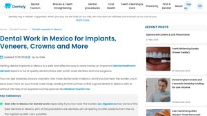 Dental Work in Mexico for Implants, Veneers, Crowns and More - best dental implants in mexico