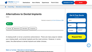 Alternatives to Dental Implants | Restore Your Missing Teeth - cheaper alternative to dental implants