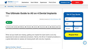 The Ultimate Guide to All on 4 Dental Implants - cheapest all on 4 dental implants