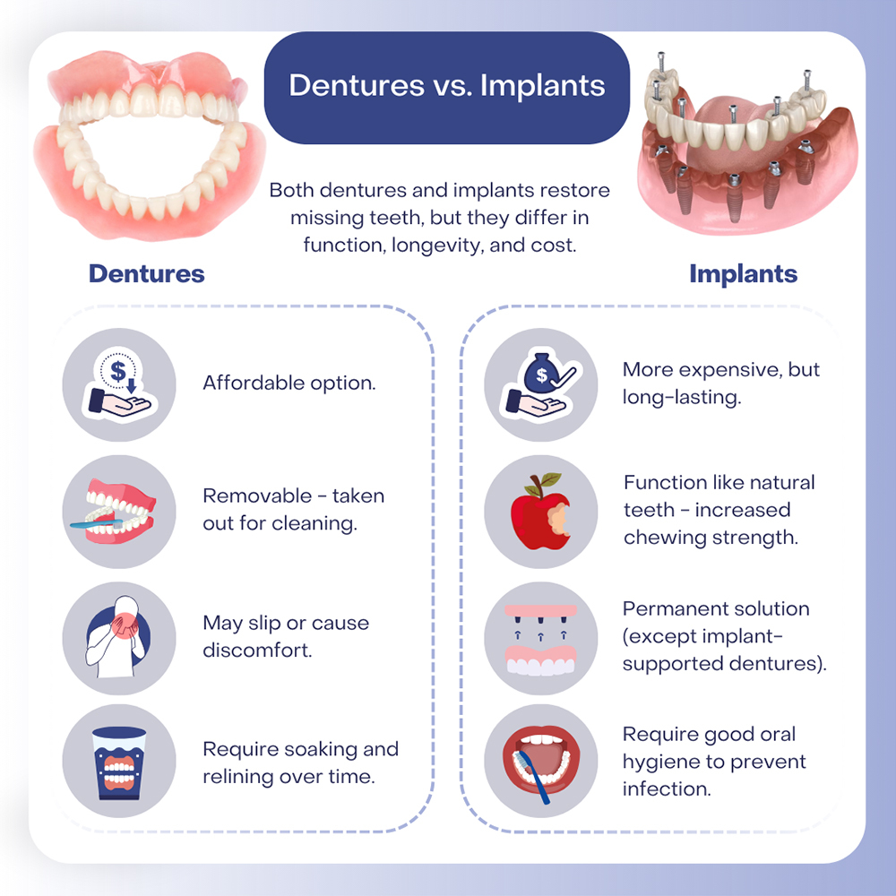 Illustrative example of denture implants vs dental implants from Google Search