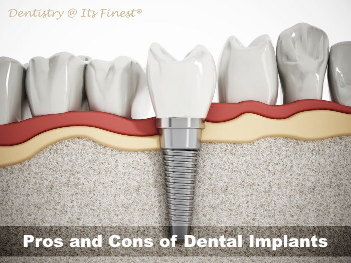 Illustrative example of disadvantages of dental implants from Google Search