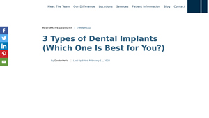 3 Types of Dental Implants (Which One Is Best for You?) - best dental implants