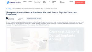 Cheapest All on 4 Implants: Smile Transformation Within Budget! - cheapest place to get all on 4 dental implants