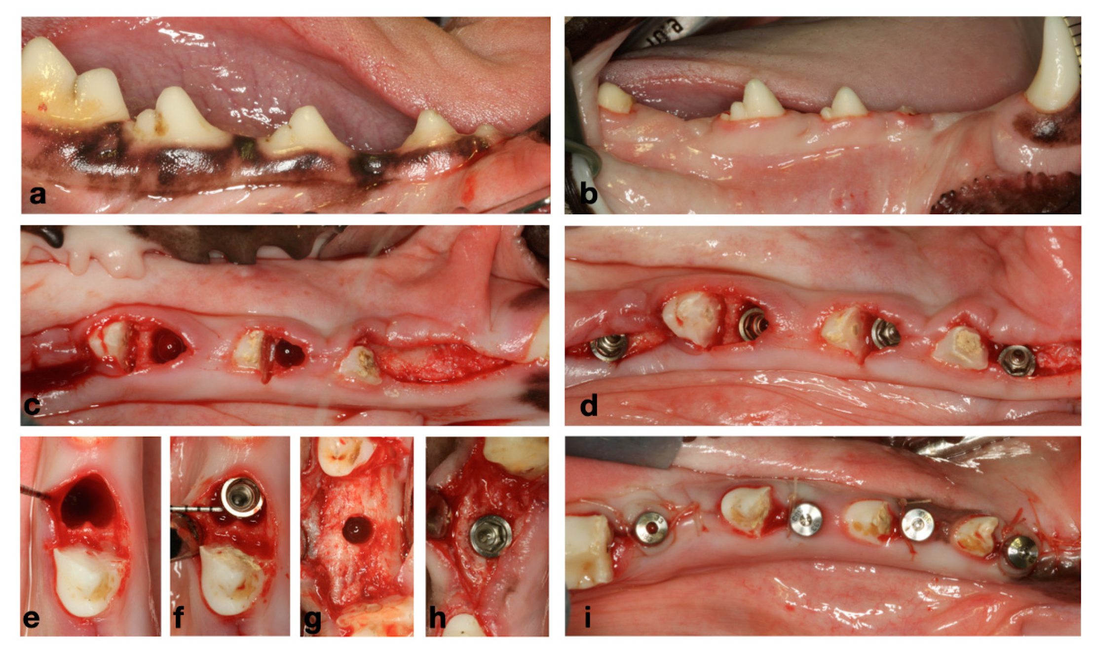 Illustrative example of healing time for dental implants from Google Search